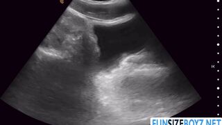 While having an ultrasound my doctor penetrates me