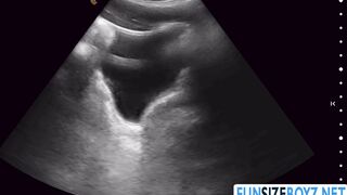 While having an ultrasound my doctor penetrates me